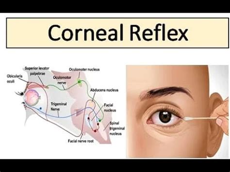 corneal-cotton or saline drop will blink test|blinking corneal reflex.